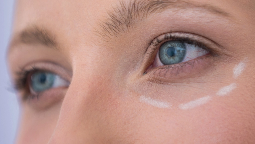 Подготовка кожи век к блефаропластике