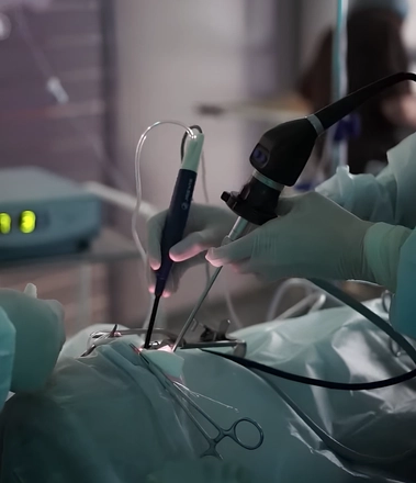 Преимущества холодноплазменной коблации