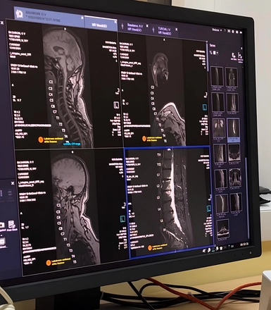 О необходимости проведения МРТ позвоночника