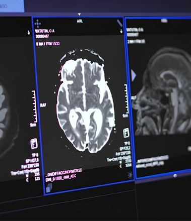 МРТ головного мозга: когда и зачем проводить исследование