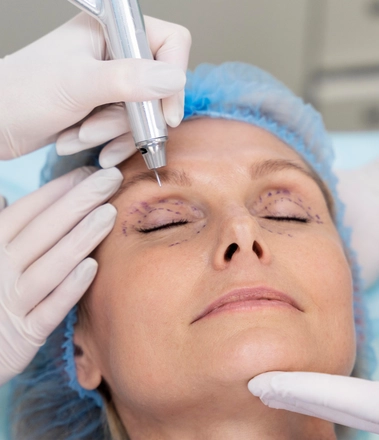 Удаление новообразований век