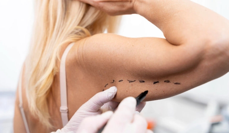 Видео-интервью с пациентом Бабаджаняна Акопа Манасовича