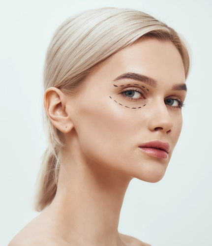 Подготовка кожи век к блефаропластике